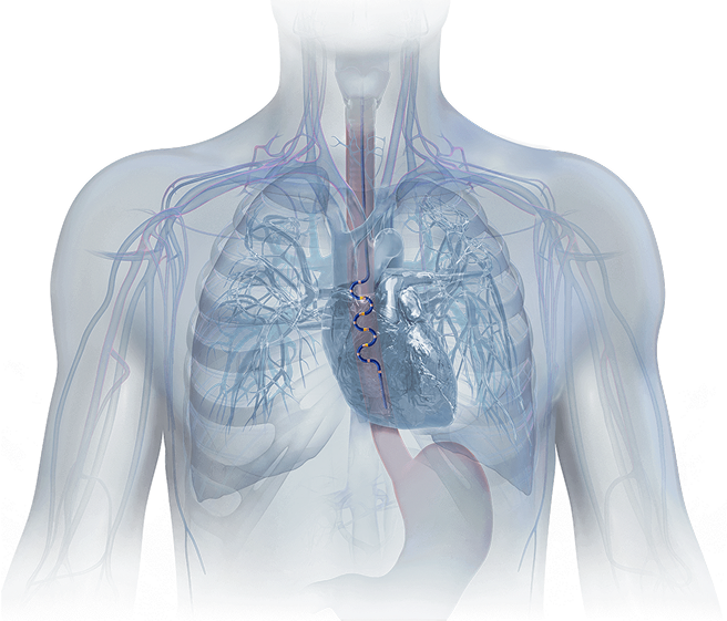Esophageal Temerpature Monitoring Solutions | CIRCA Scientific
